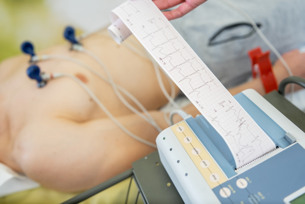ECG Electrocardiogram in Horizon Hills Iskandar Puteri